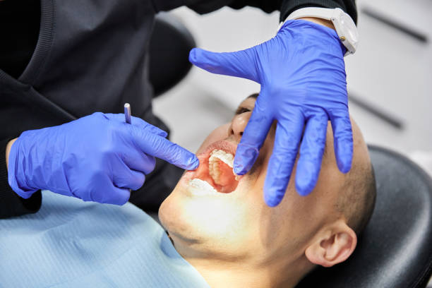 Best Emergency Dental Care for Broken or Chipped Teeth in Malibu, CA